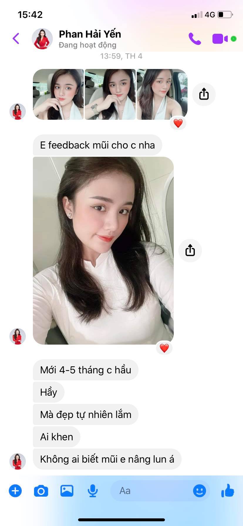 phẫu thuật nâng mũi tại nghệ an