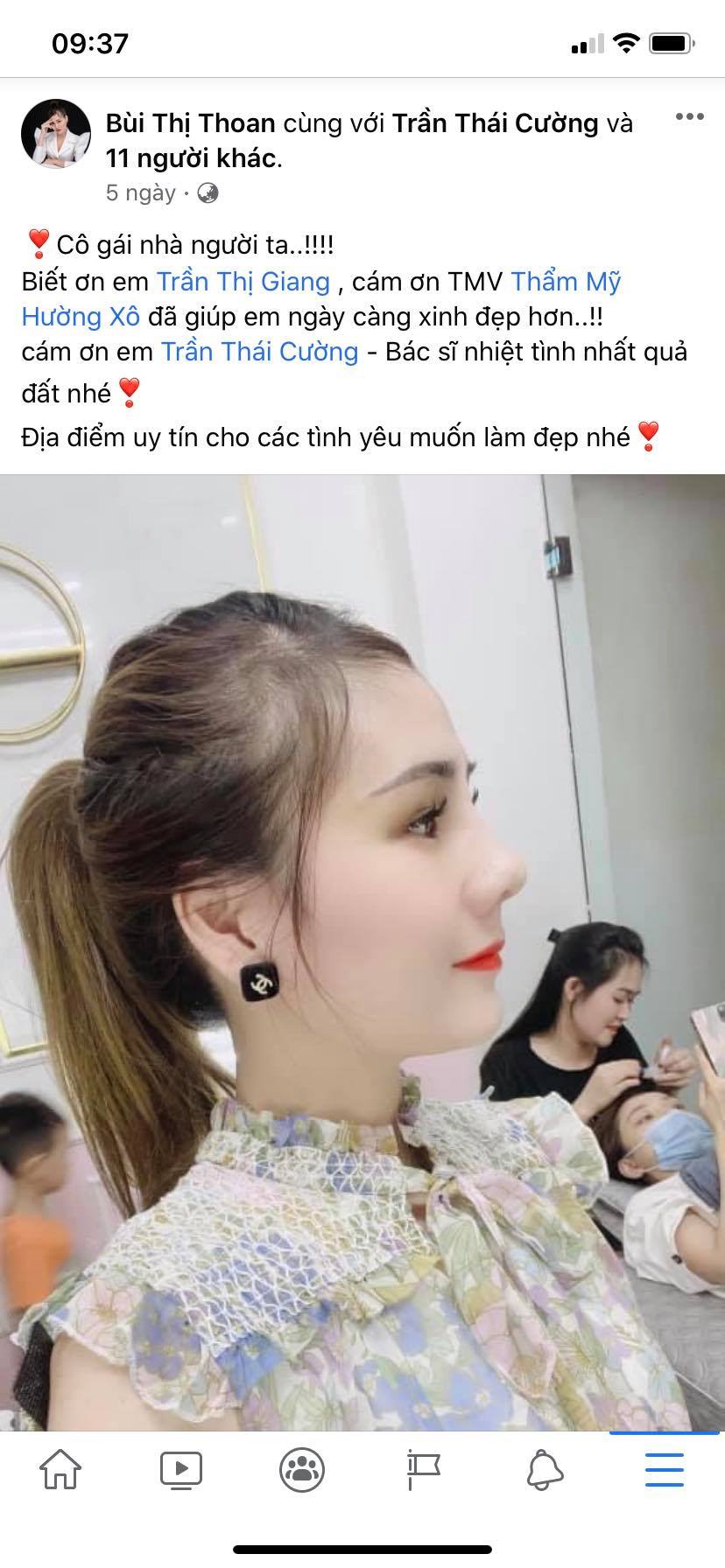 phẫu thuật nâng mũi tại nghệ an