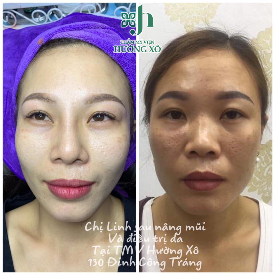 thẩm mỹ tại vinh nghệ an