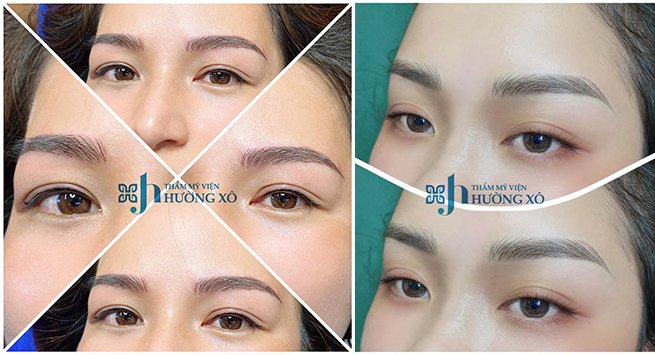 thâm mỹ tại vinh nghệ an