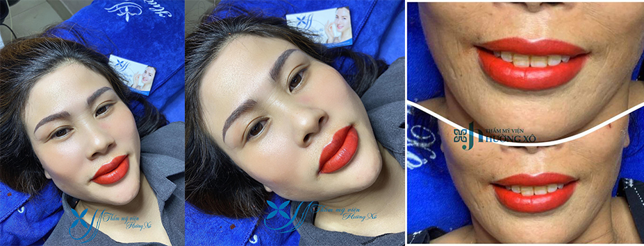 thâm mỹ tại vinh nghệ an