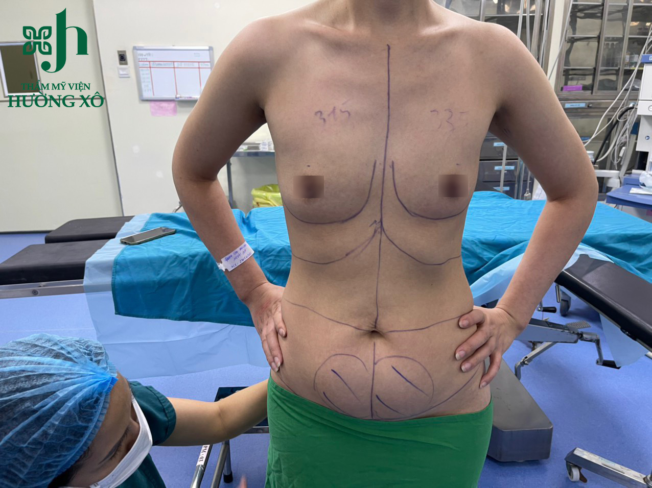 Hút Mỡ Vaser Lipo - Nâng Ngực Nano Chip tại Vinh, Nghệ An