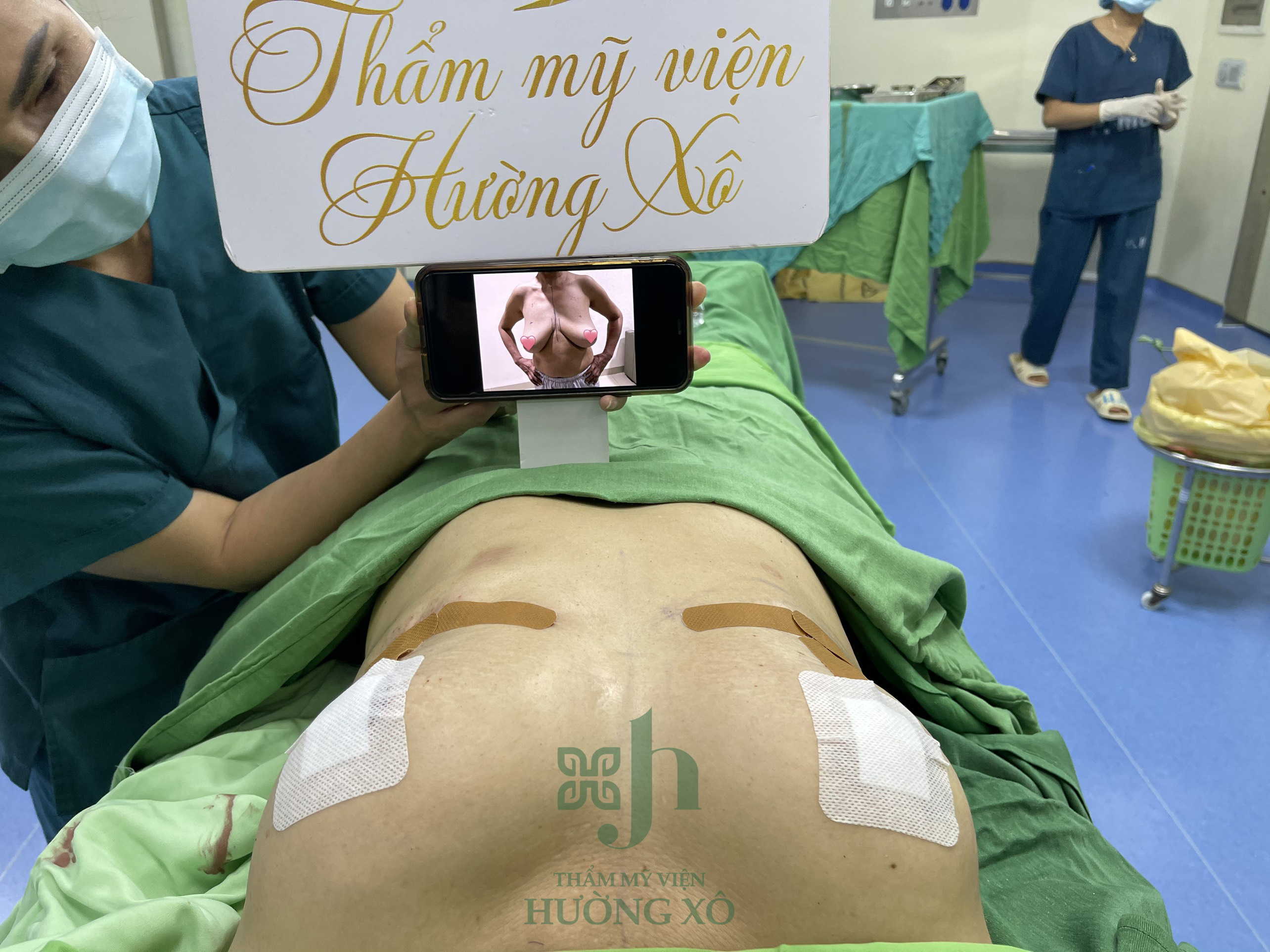 Hút Mỡ Vaser Lipo - Nâng Ngực Nano Chip tại Vinh, Nghệ An