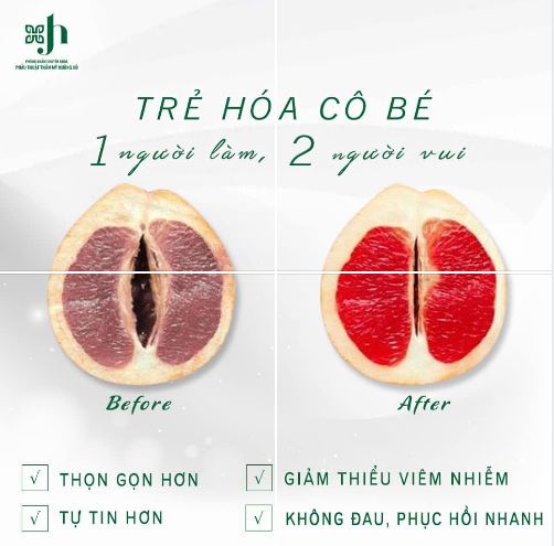 thu nhỏ cô bé tại vinh nghệ an