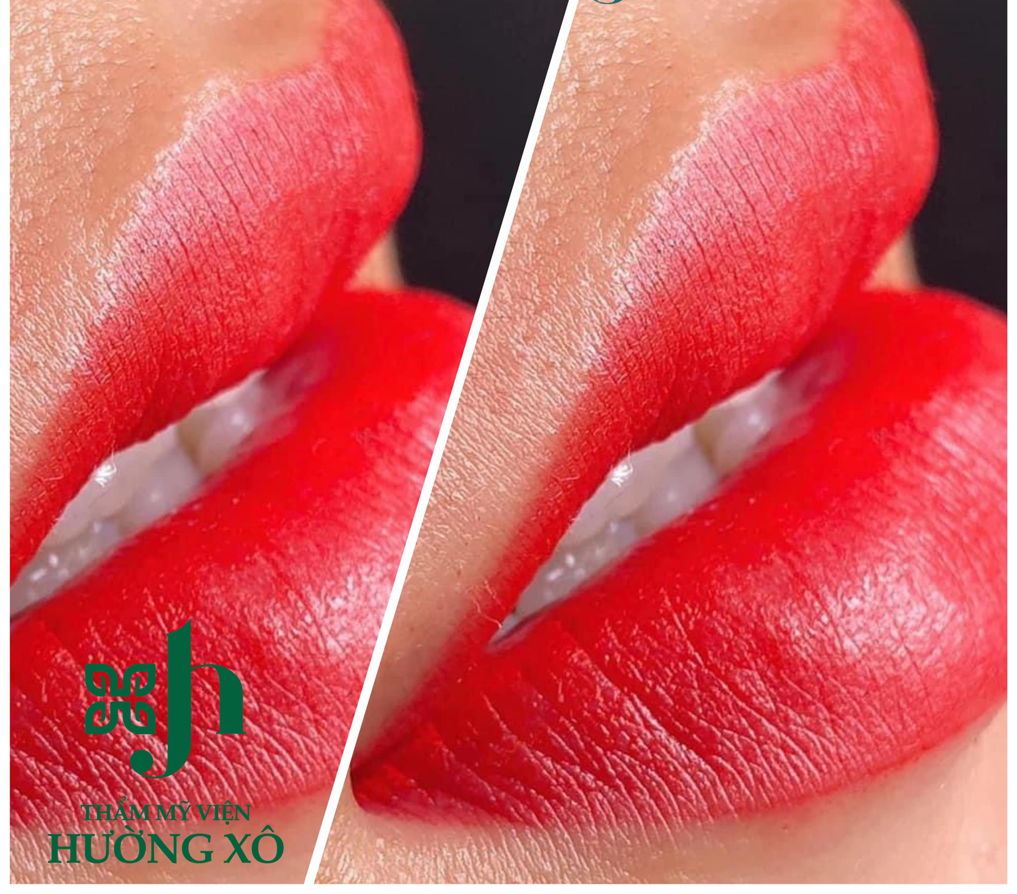 phun xăm môi tại Hà Tĩnh