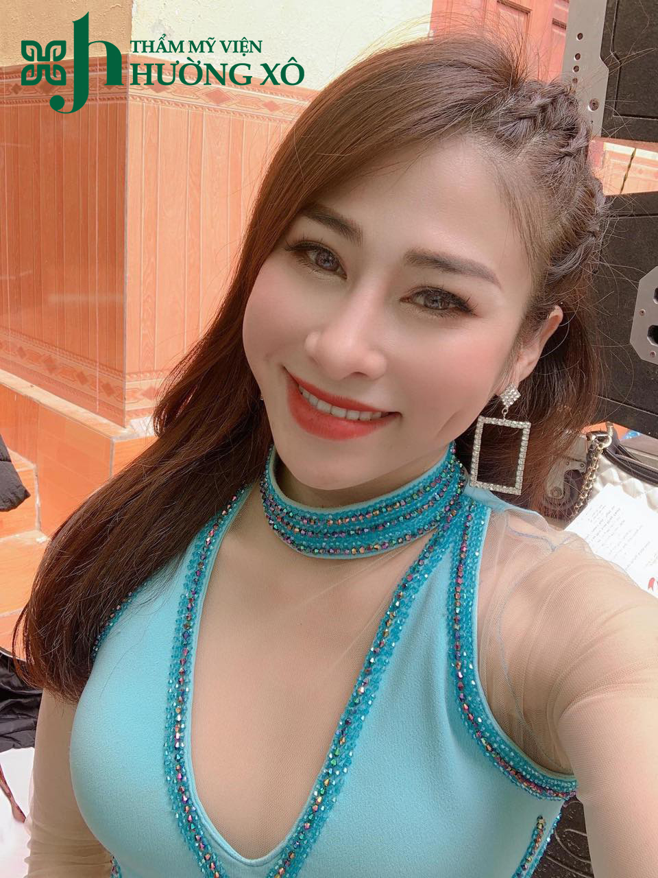 má lúm đồng tiền tại Vinh Nghệ An