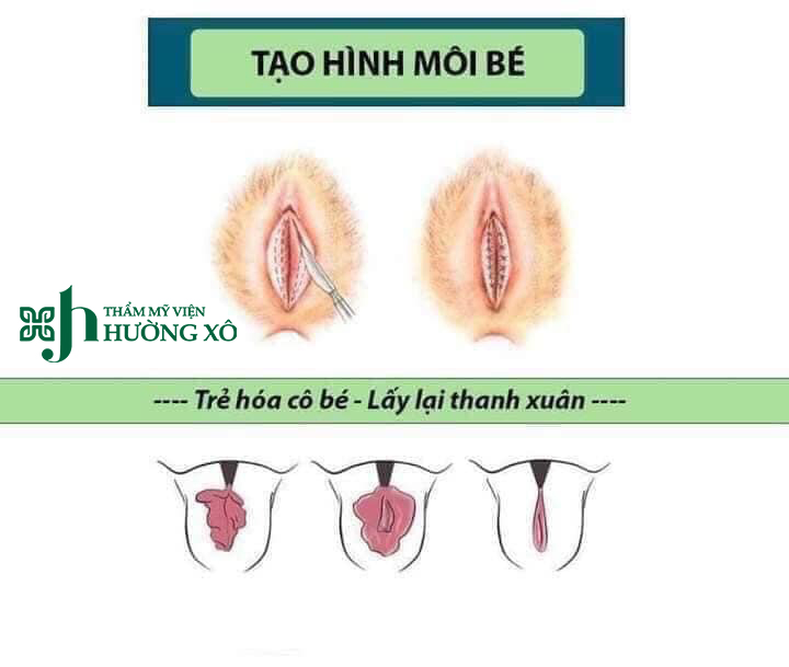 làm đẹp cô bé tại vinh