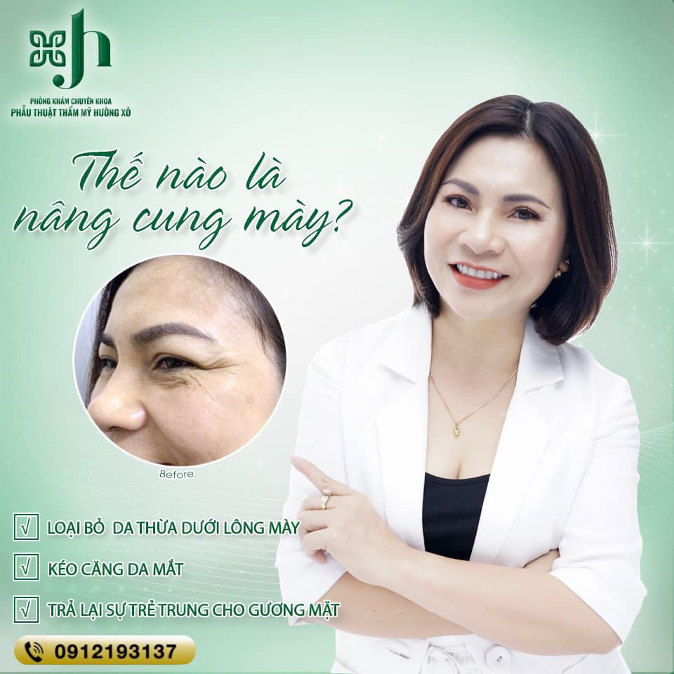 nâng cung mày tại Vinh, Nghệ An