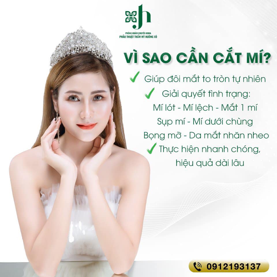 Cắt mí nội soi tại Vinh