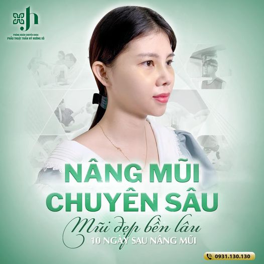 phẫu thuật nâng mũi tại nghệ an