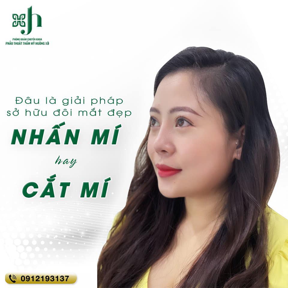 cắt mí nội soi tại vinh