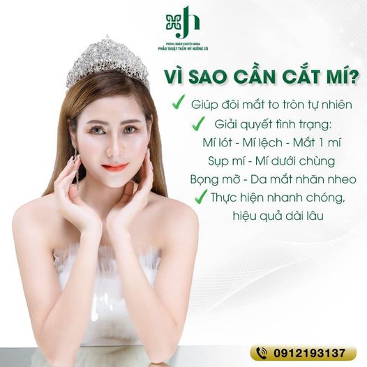 Cắt mí nội soi tại vinh