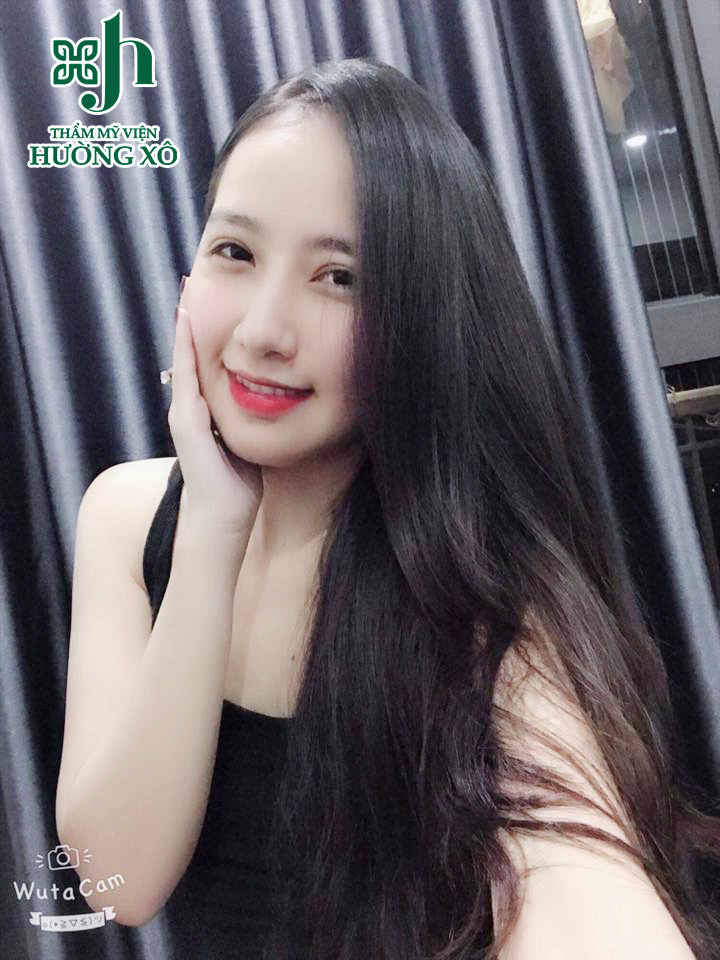 Độn cằm tại Vinh, Nghệ An