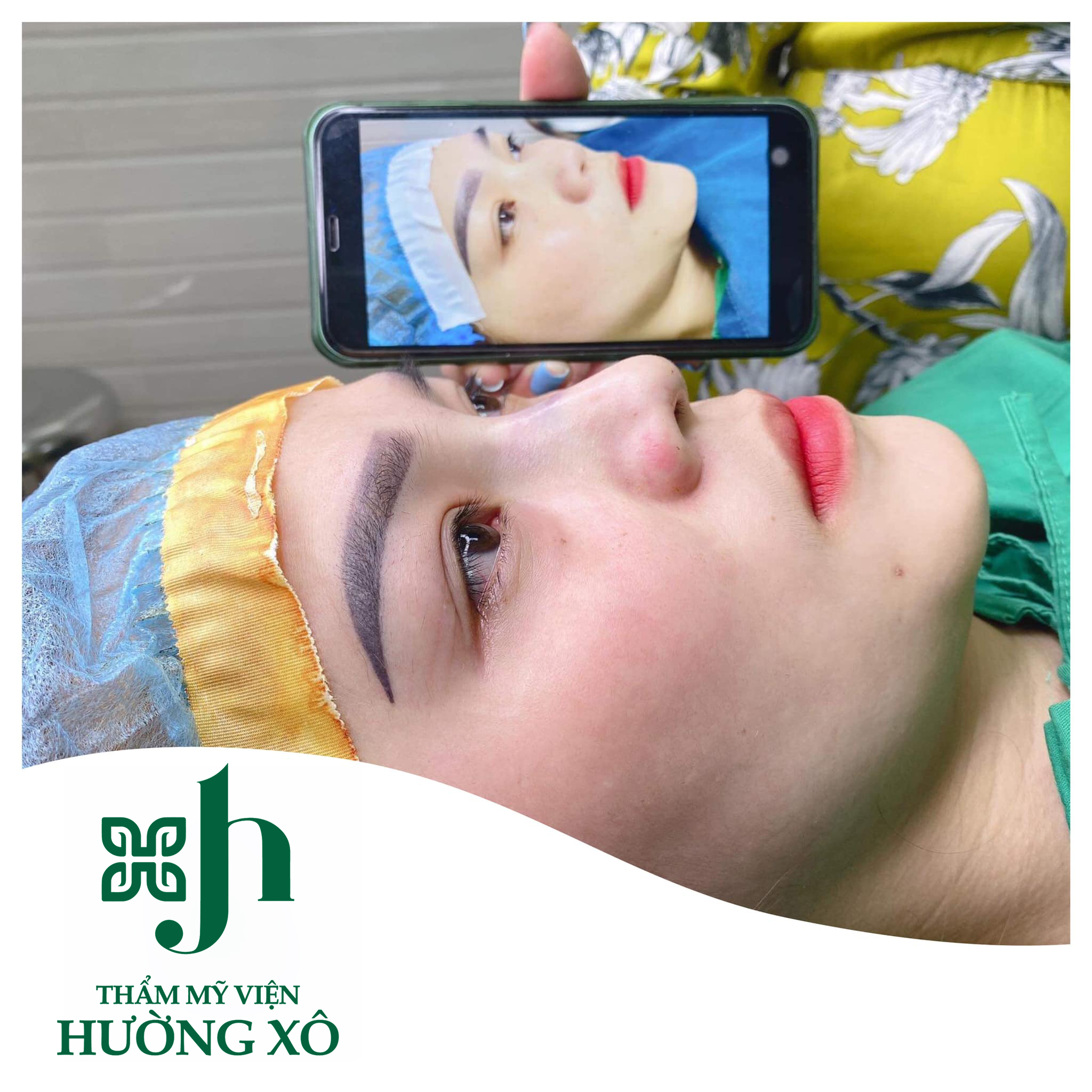 nâng mũi tại vinh nghệ an