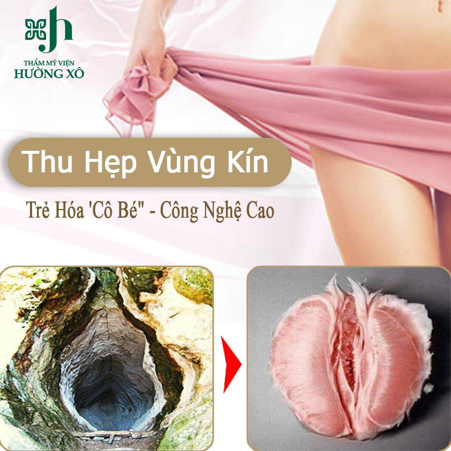 trẻ hóa âm đạo tại Vinh