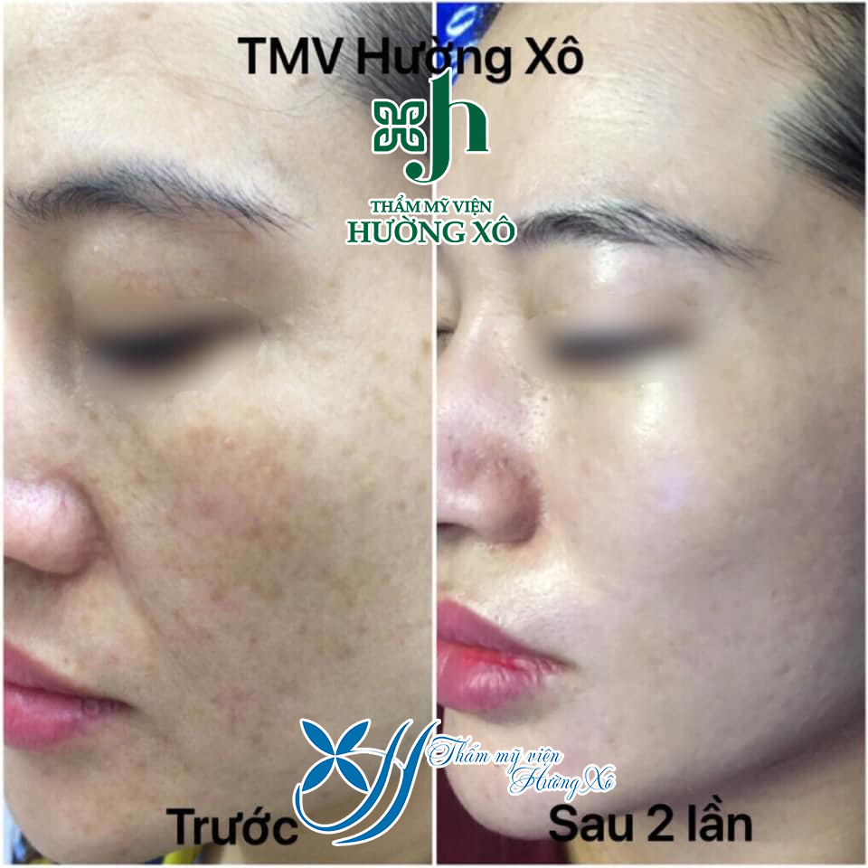 chăm sóc điều trị da tại vinh nghệ an