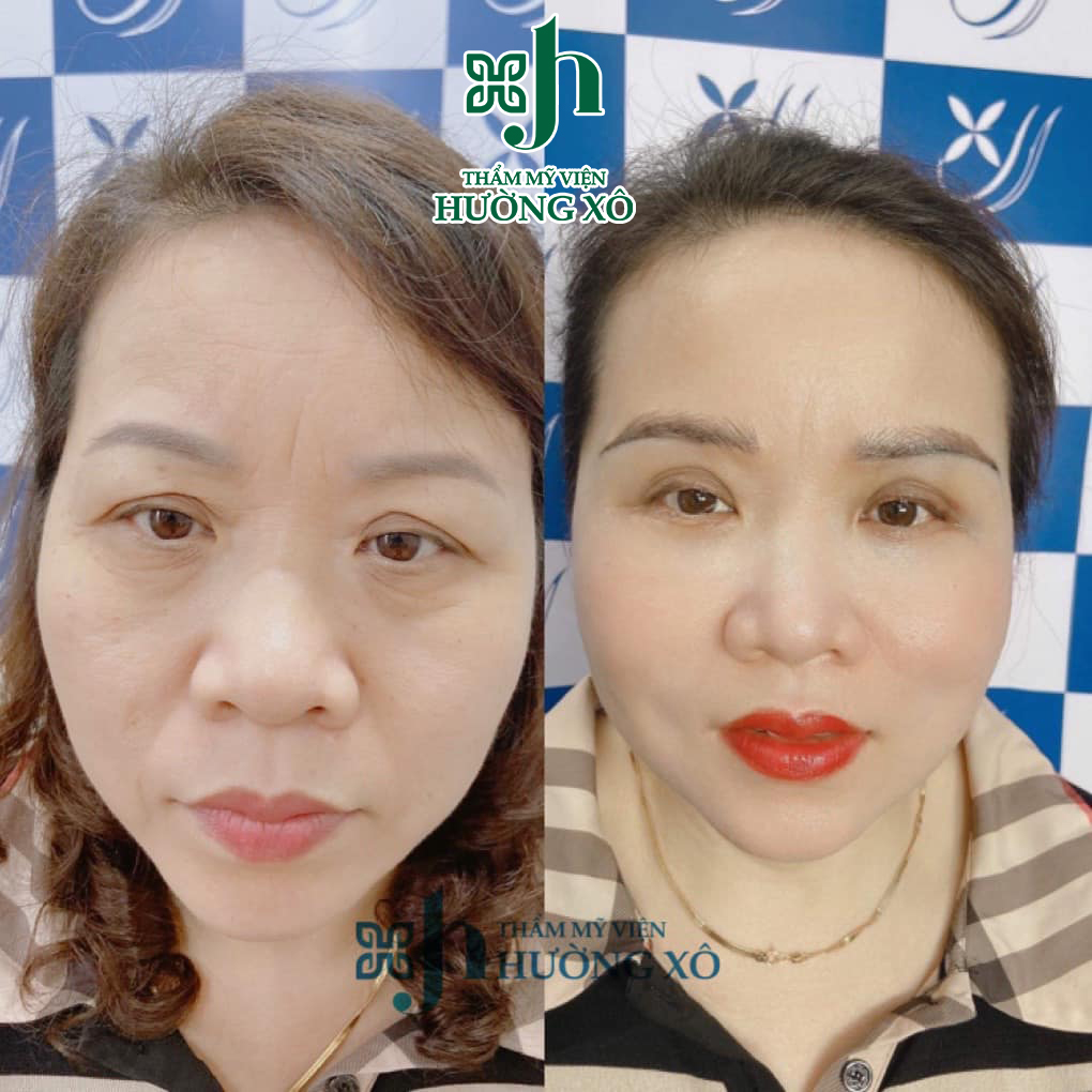 chăm sóc điều trị da tại vinh nghệ an