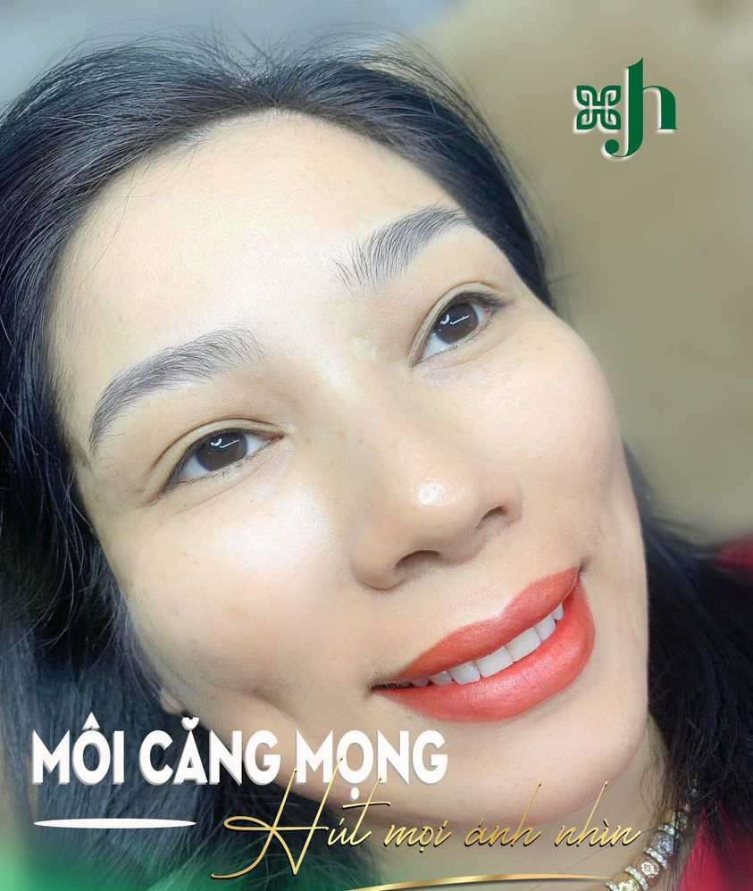 phun moi collagen tai Ha Tinh