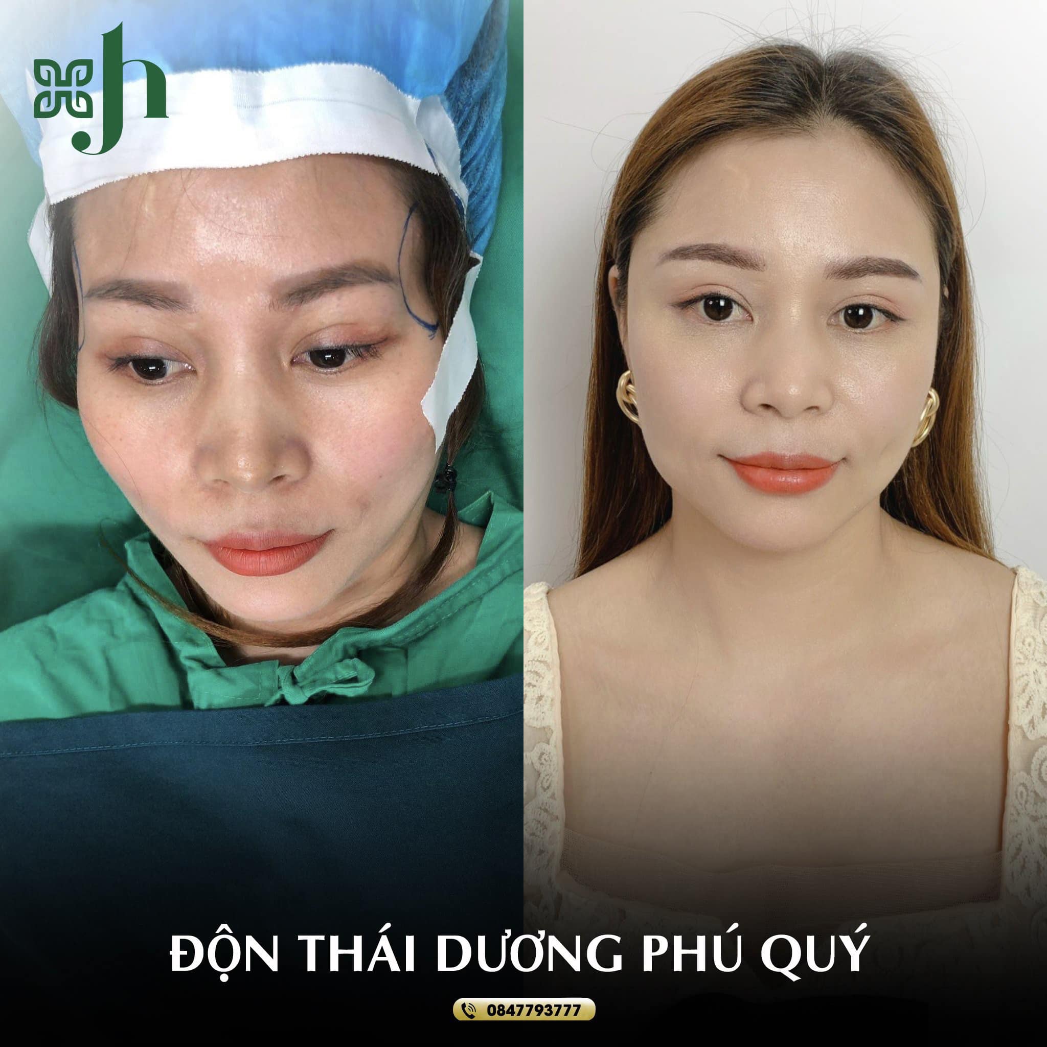 Don Thai Duong tai Ha Tinh