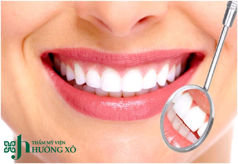 Bọc răng sứ tại Vinh