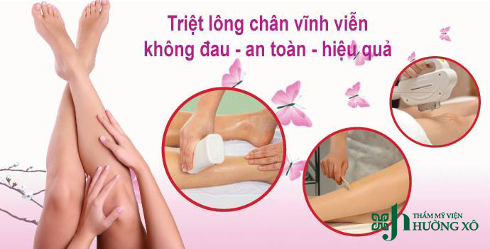 Triệt lông laser diode