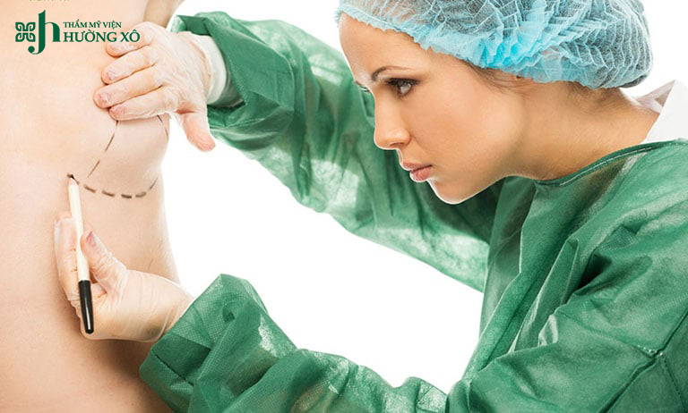 thu gọn quầng nhũ hoa tại Hà Tĩnh