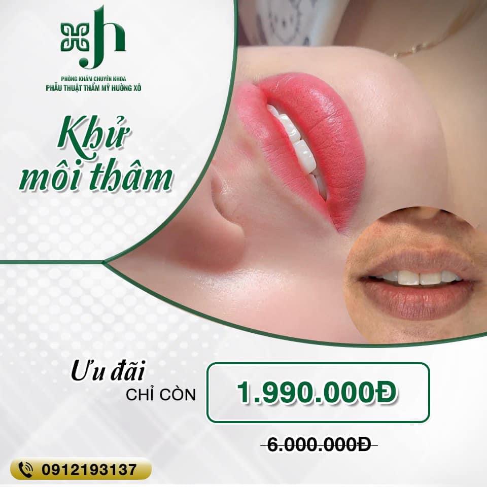 Khử thâm môi uy tín tại Hà Tĩnh