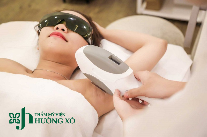 Triệt lông uy tín tại Vinh, Nghệ An