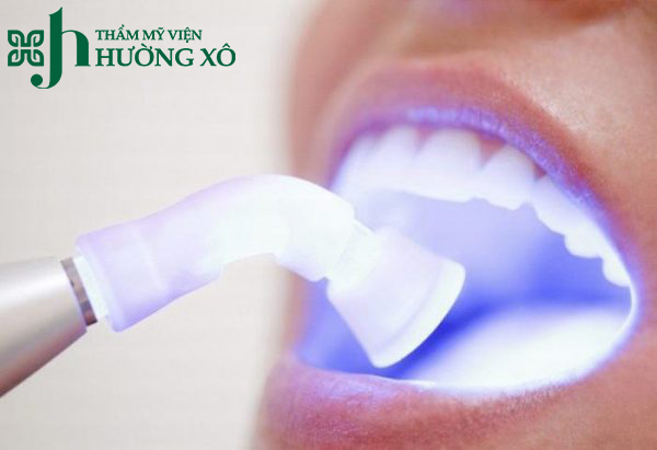 Tẩy trắng răng tại Vinh