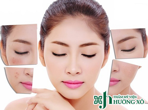 Thay da sinh học tại Hà Tĩnh