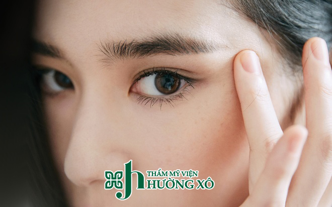 cắt mí nội soi Hà Tĩnh