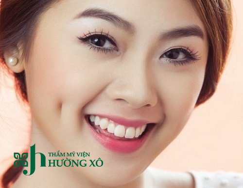 tạo má lúm đồng tiền tại vinh