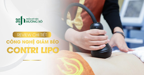 giảm béo Contri Lipo tại Vinh