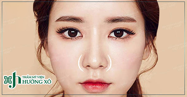 thu gọn cánh mũi tại Hà Tĩnh