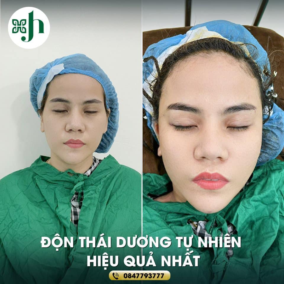 Độn thái dương uy tín tại Vinh