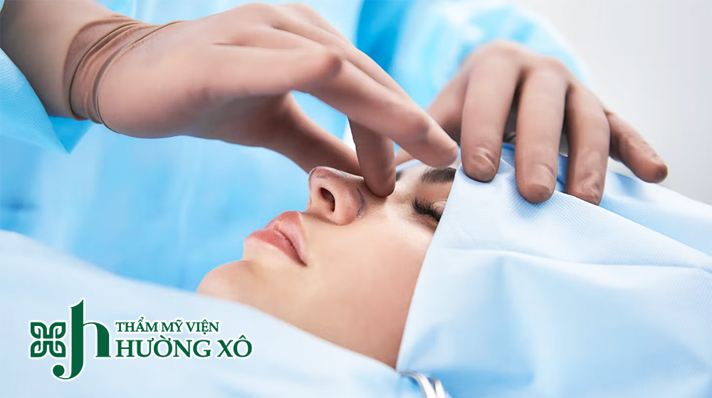 Nâng mũi cấu trúc tại Vinh