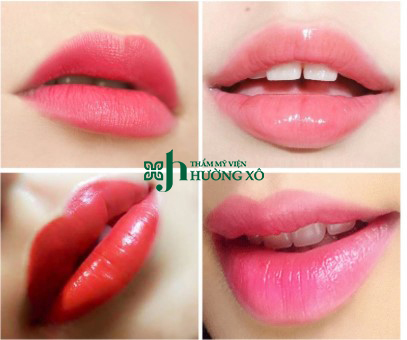 Phun môi collagen tại Vinh