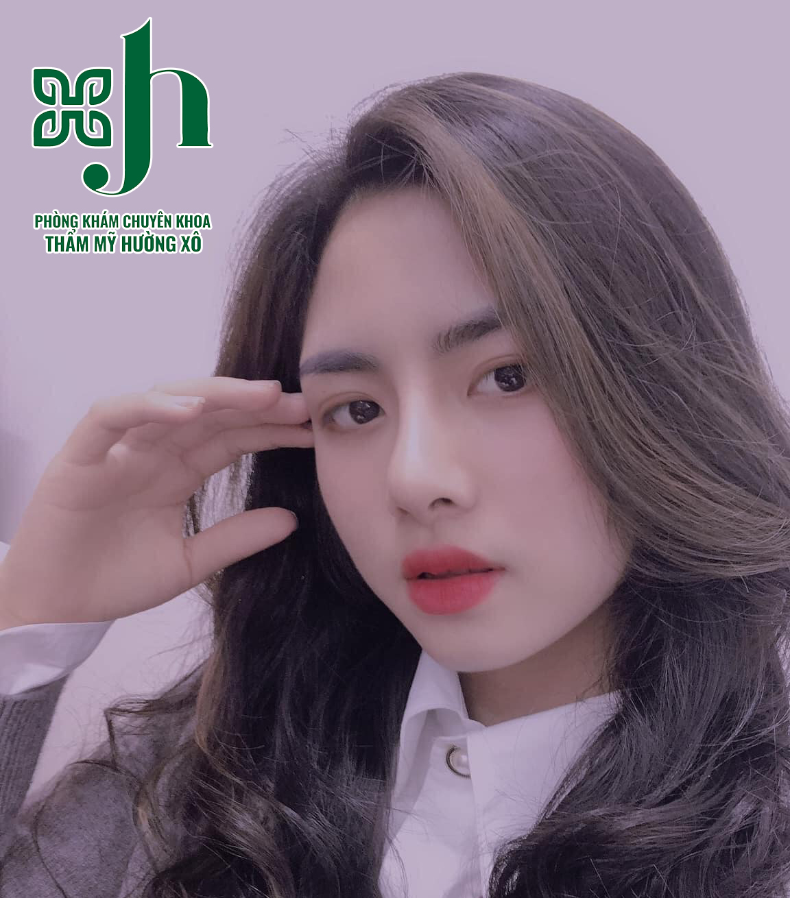 nâng mũi S Line tại Vinh