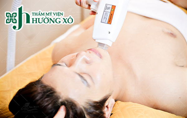 Triệt lông mép tại Vinh