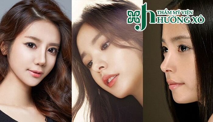 Nâng mũi cấu trúc tại Vinh