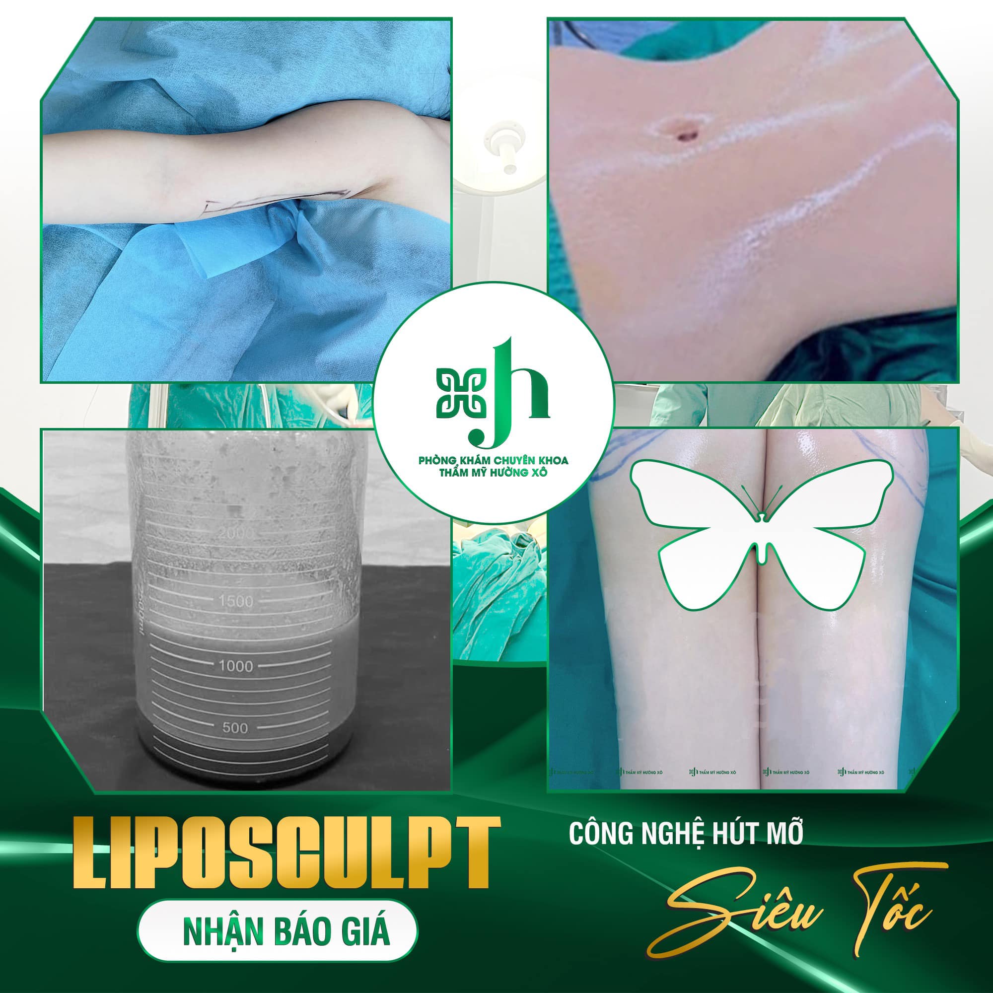 Dịch vụ hút mỡ an toàn, uy tín tại Hà Tĩnh