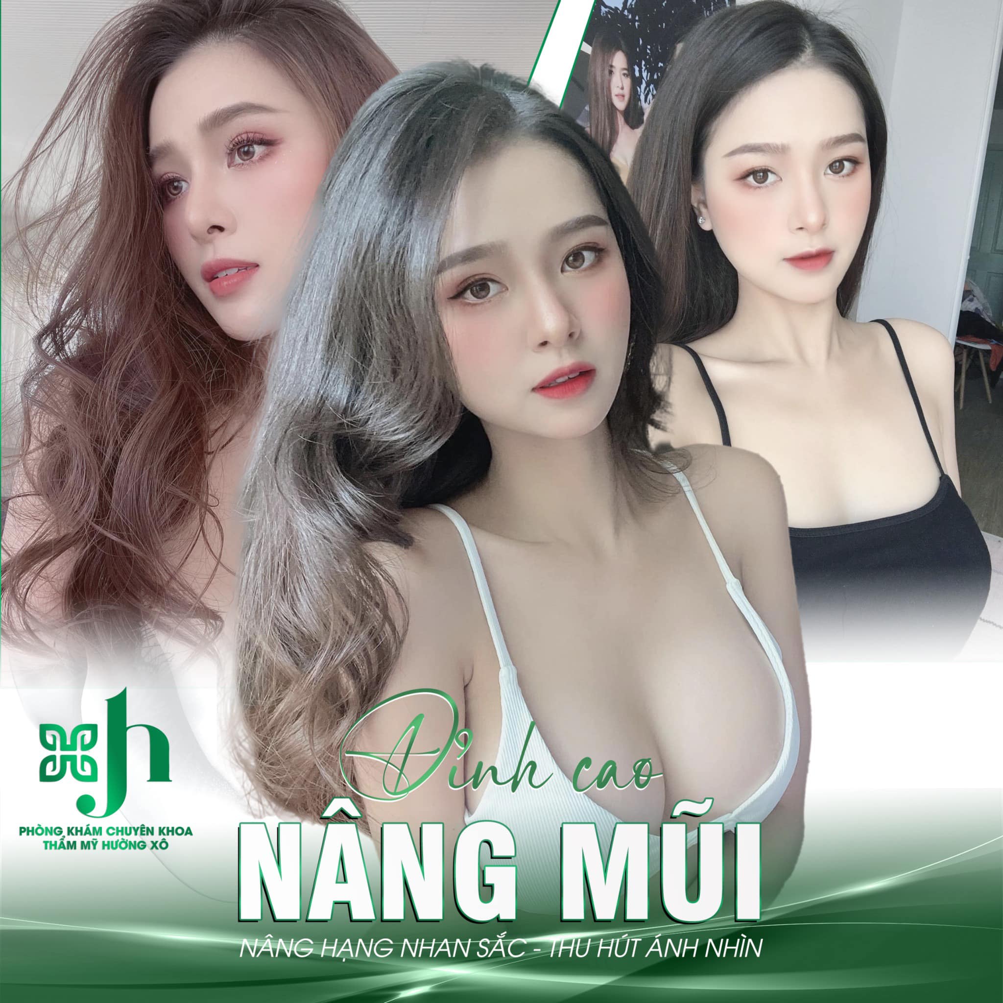 Dịch vụ nâng mũi cấu trúc tại Hà Tĩnh