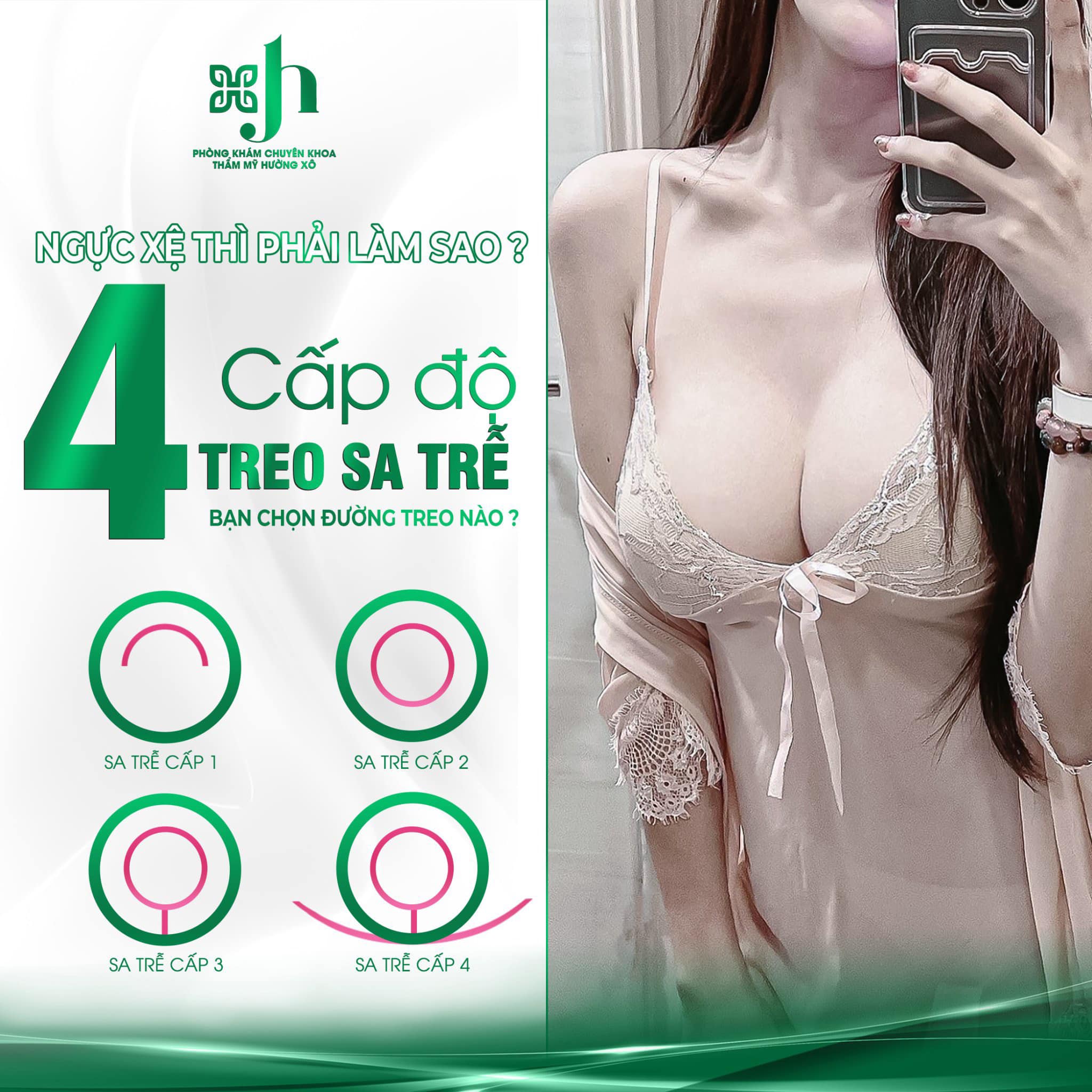 Địa chỉ treo ngực sa trễ uy tín tại Vinh, Nghệ An 