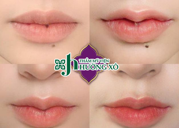 tạo môi trái tim tại Hà Tĩnh