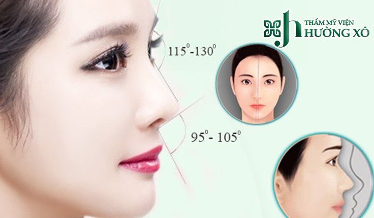 nâng mũi L Line tại Vinh