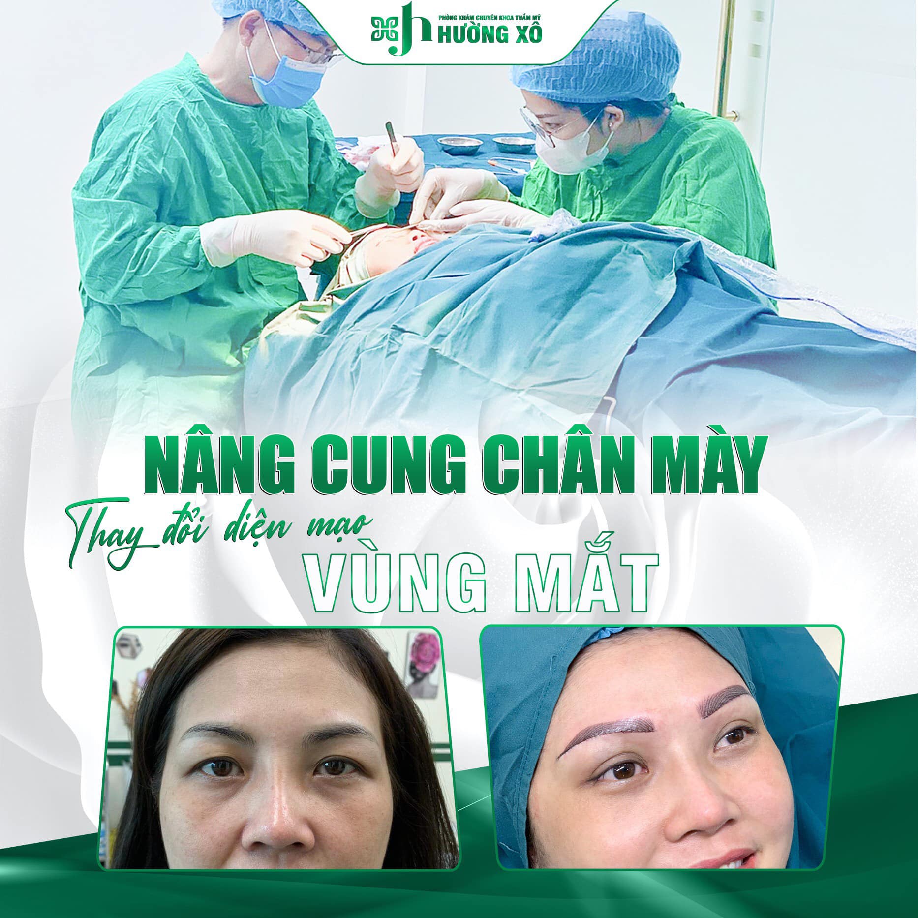 Thẩm mỹ mắt 