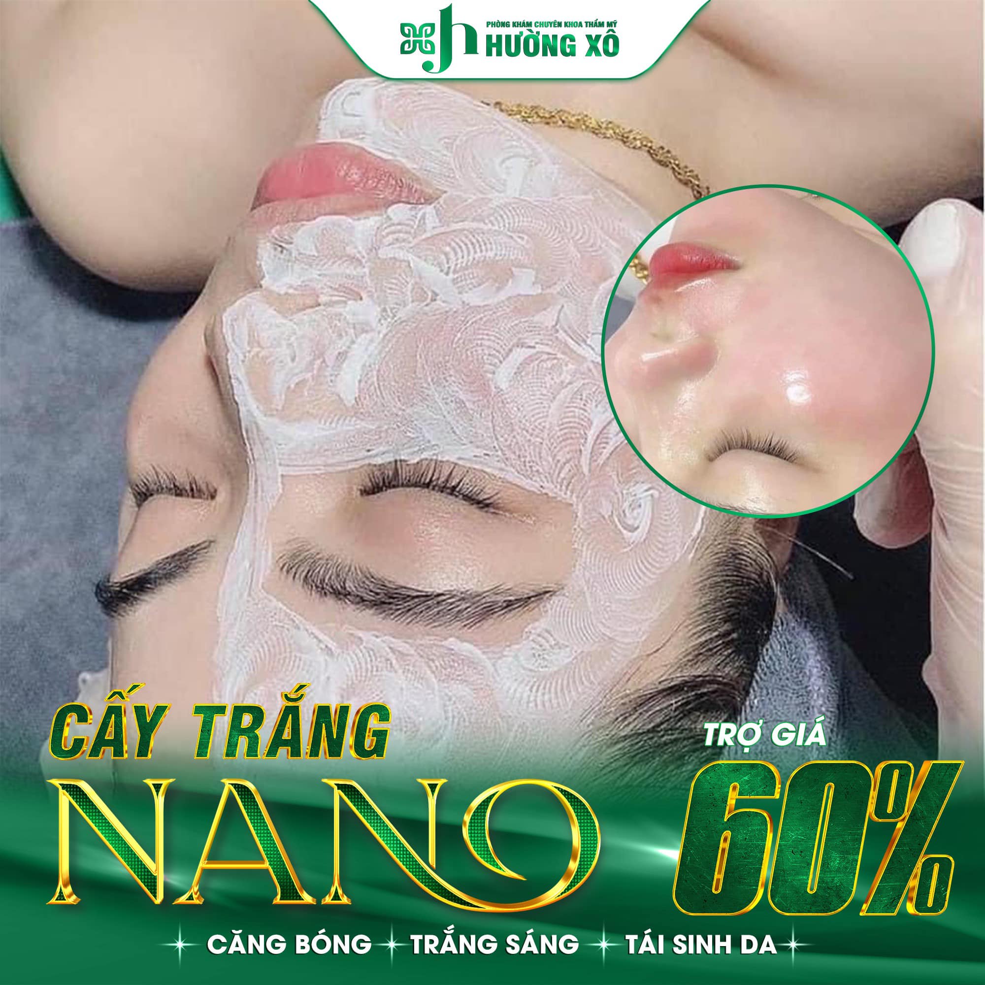 Cấy trắng da mặt