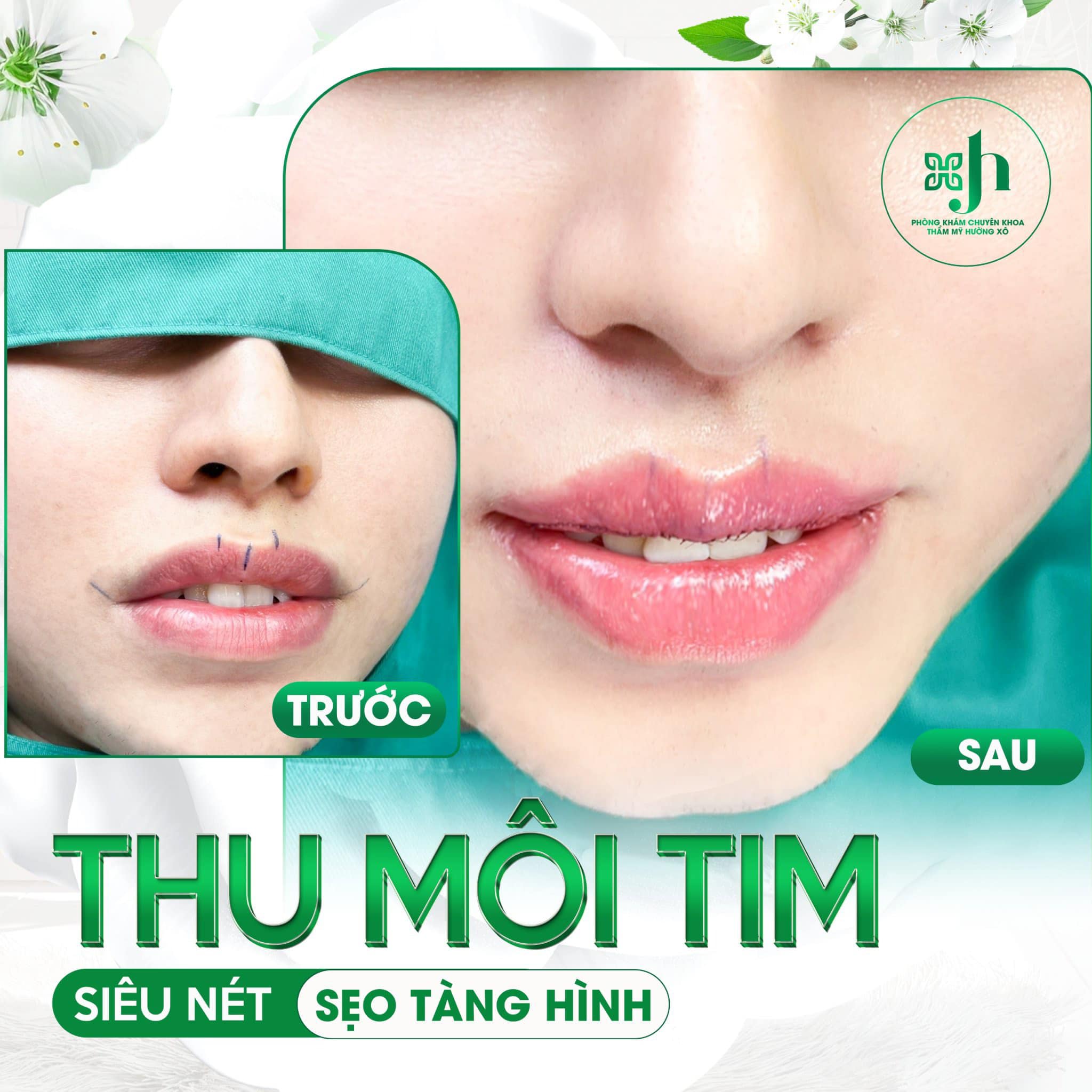 Tạo môi trái tim