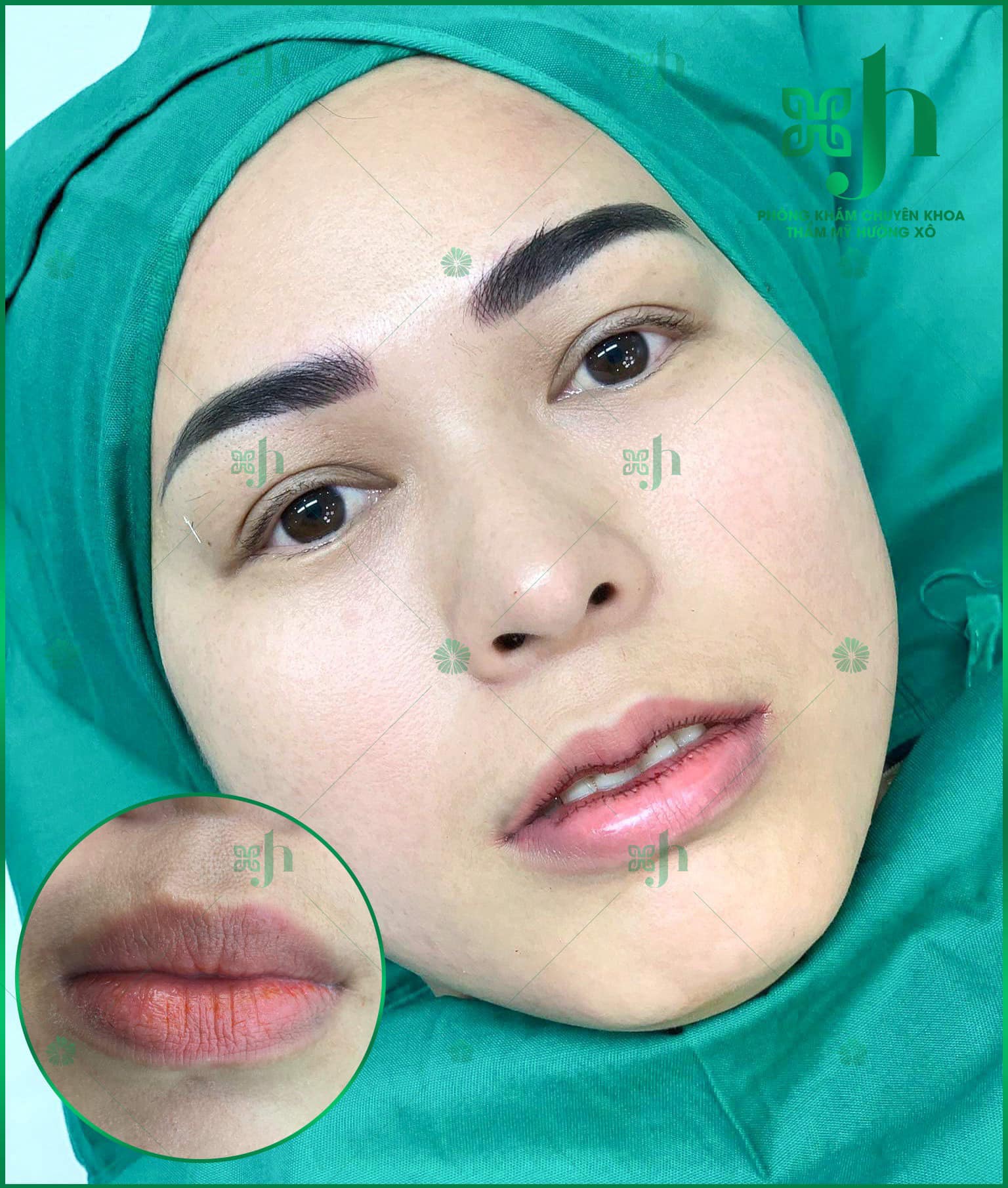 Tạo môi trái tim