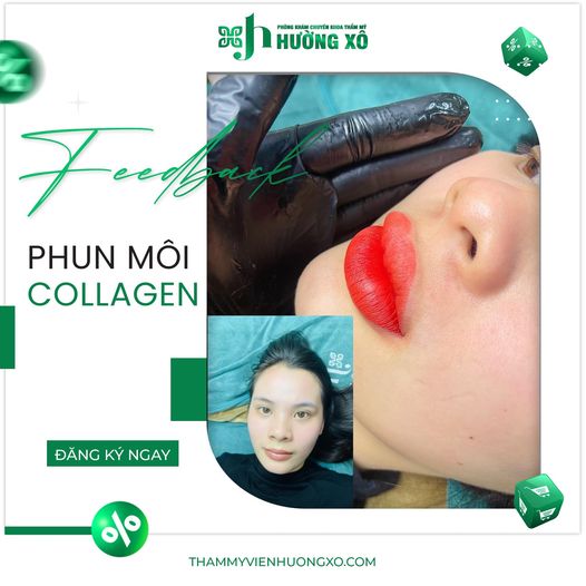 Phun môi collagen